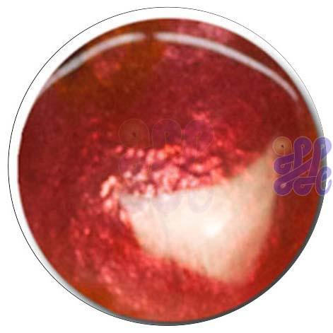 S340 Light Red 30g